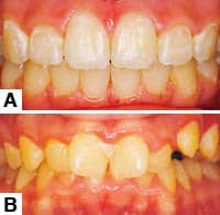 Figure 1, A and B. Figure 1, A and B.