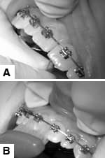 Figure3: A and B. Figure 3: A and B.