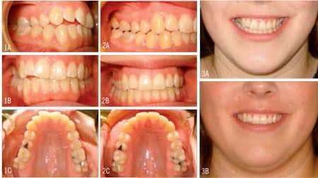 Nicozisis Case1