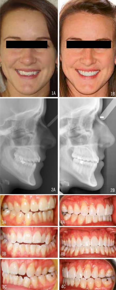 Nicozisis Case2