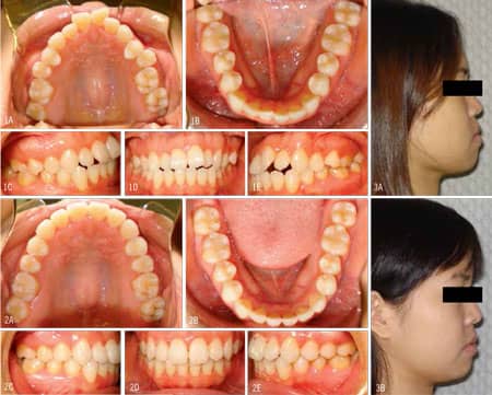 Nicozisis Case3